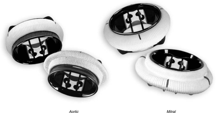 On-X mechanical aortic and mitral heart valves